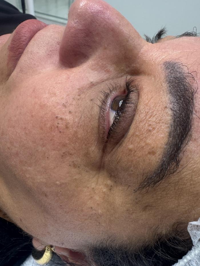 Antes